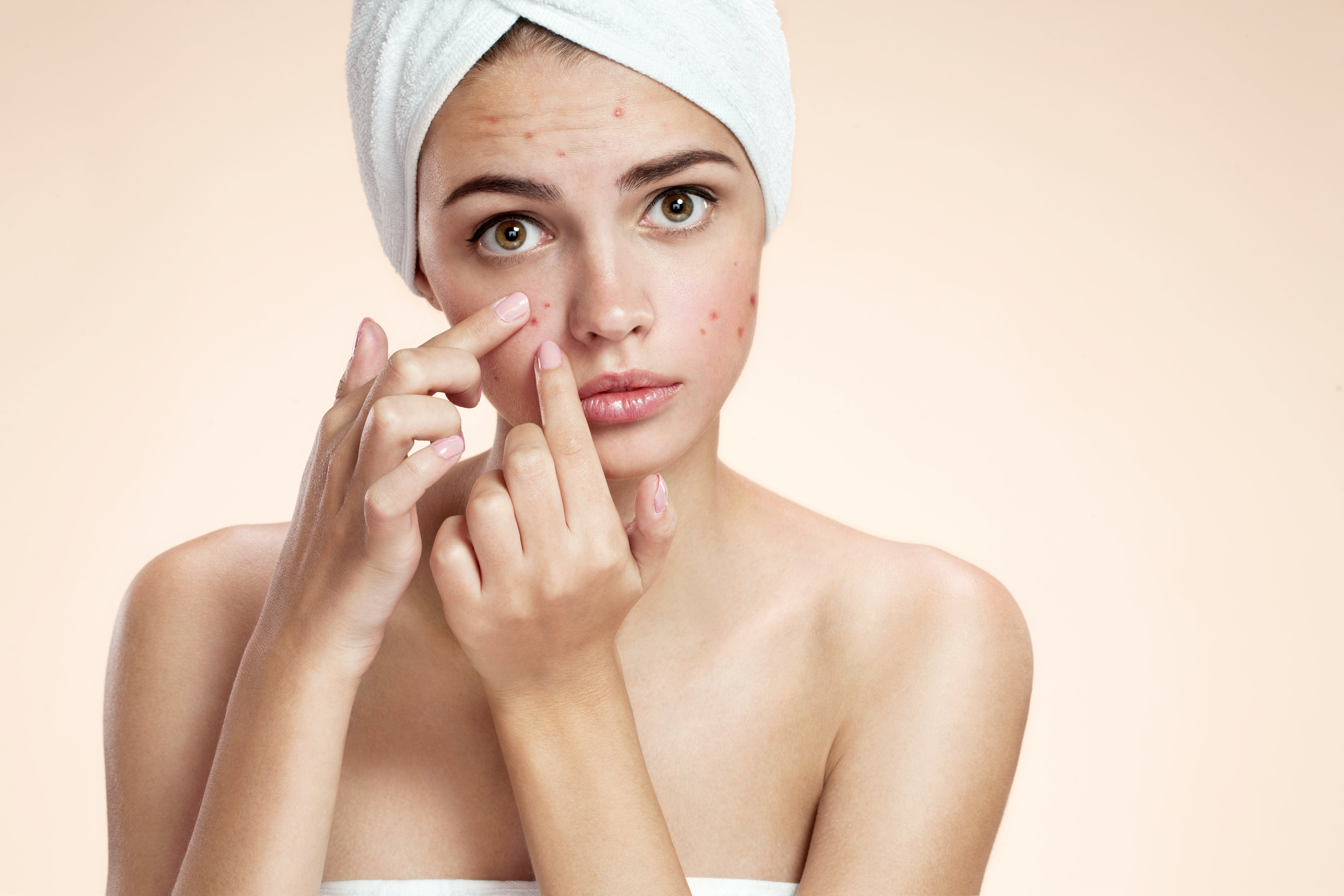 Short Stories: What's the Deal with Pimple Patches?